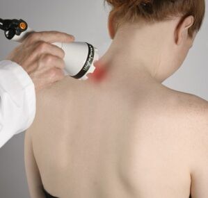 A terapia a laser ajudará a aliviar a inflamação e ativar a regeneração dos tecidos do pescoço