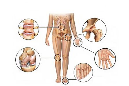 Tipos de artrose