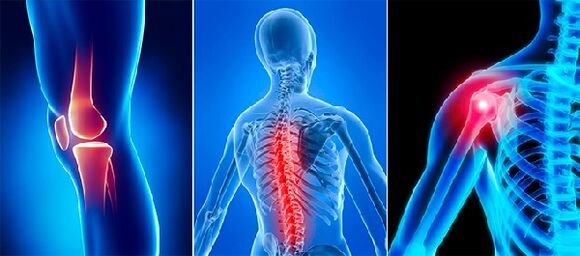 Dor articular na artrose